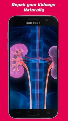 Repair Your Kidneys Naturally android App screenshot 0